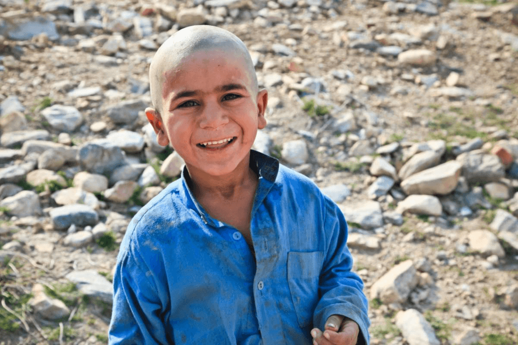 Bald is Beautiful Day (Friday, September 13th, 2024)