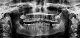 X-ray Day